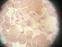 Trypanosomiasis in Horses